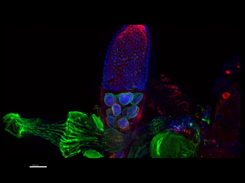 SDCM – Lokalizace RNA metodou FISH