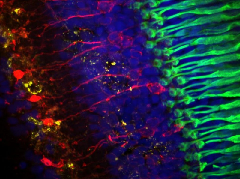 Optogenetika – světelná stimulace neuronů