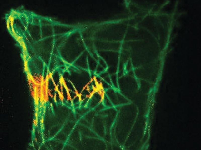 FRAP – Remodelace chromatinu